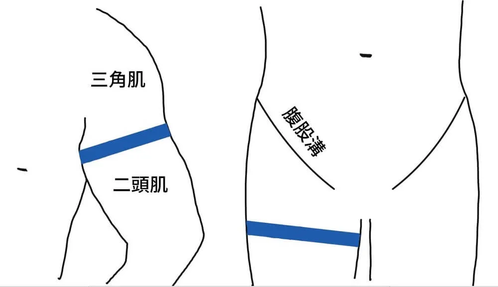 手繪線稿,左邊上臂的藍色綁帶綁在三角肌之下、二頭肌之上,右邊綁帶橫綁在腹股溝下方的大腿根部
