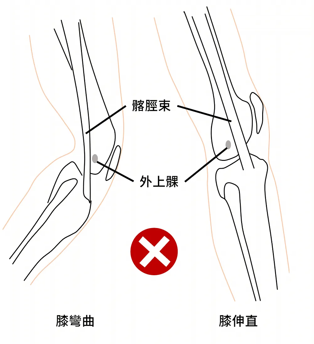 髂脛束並不會來回摩擦股骨