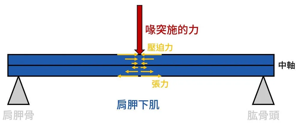肩胛下肌會因關節面側張力過強而撕裂