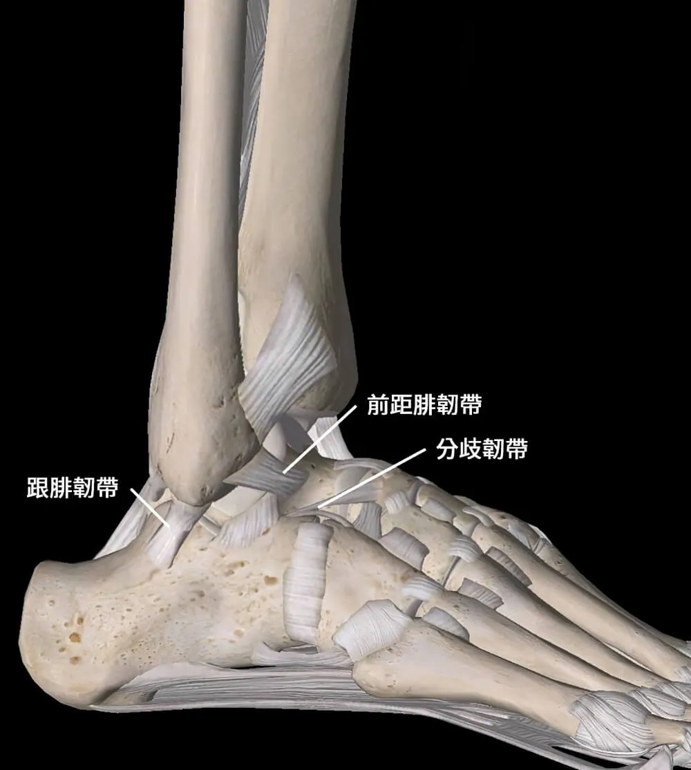 腳踝外側骨骼解剖圖，標示外踝下方的跟腓韌帶、前方的前距腓韌帶與分歧韌帶