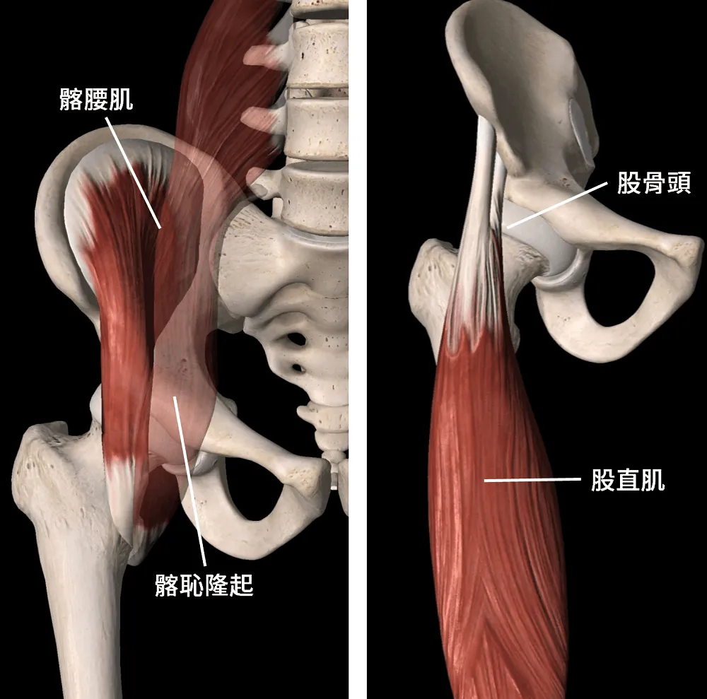 內部型彈響髖可能是因髂腰肌或股直肌而致