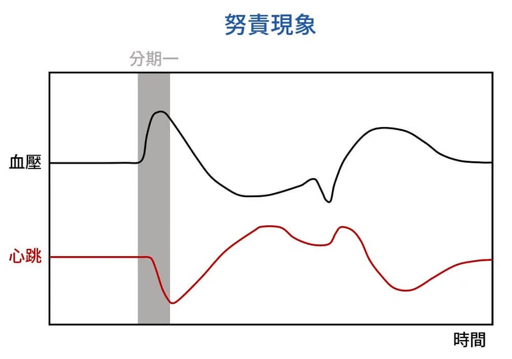 努責現象｜分期一