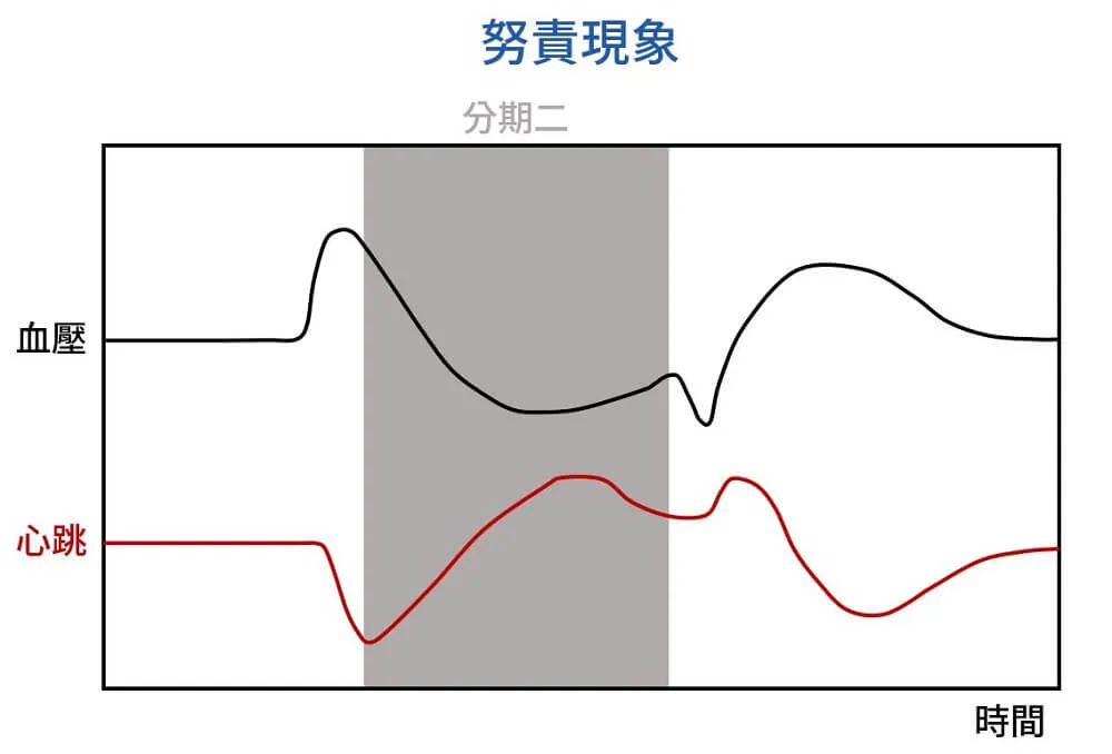 努責現象｜分期二